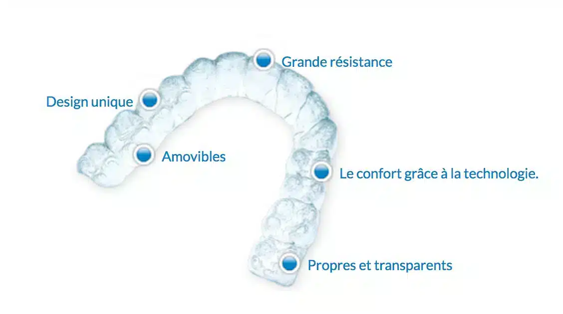 contention-amovible-vivera Orthodontic treatment in Brussels - open bite