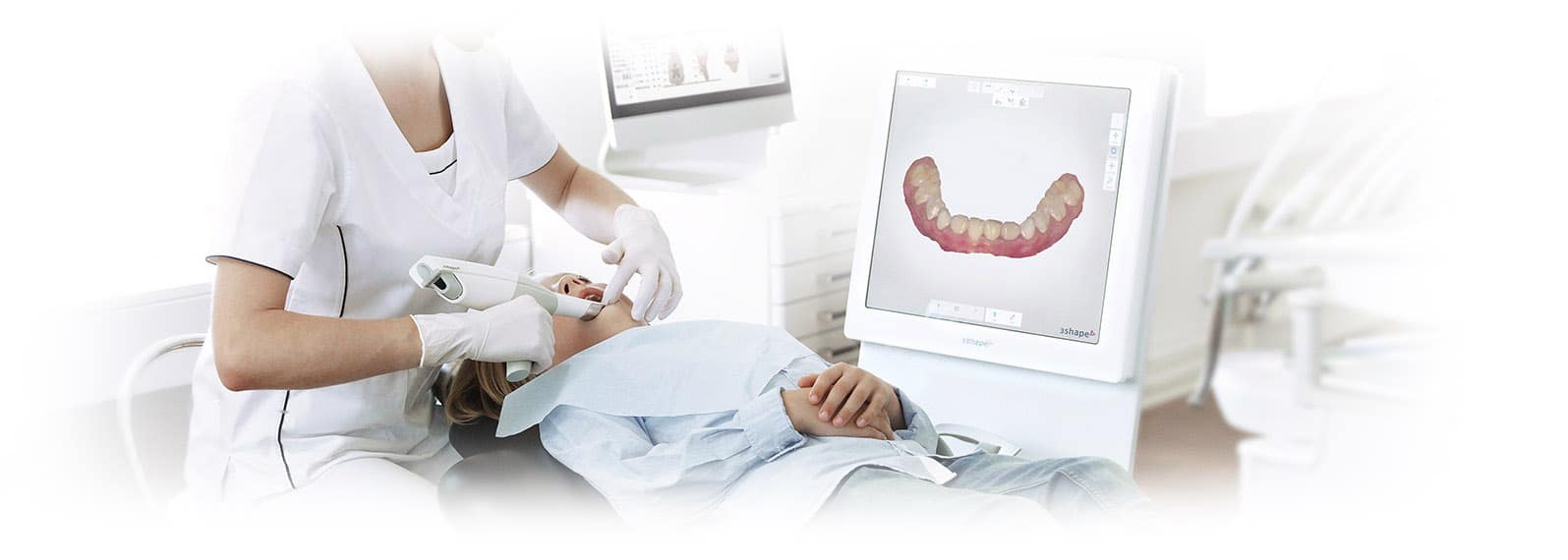 empreinte-optique-orthodontie-bruxelles Orthodontic treatment in Brussels - open bite