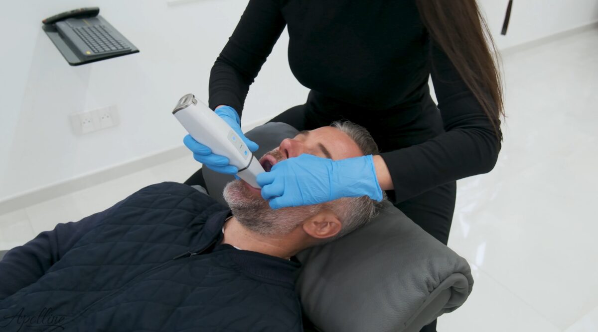 Empreinte optique réalisée avec un scanner intra-oral à la Clinique Apolline