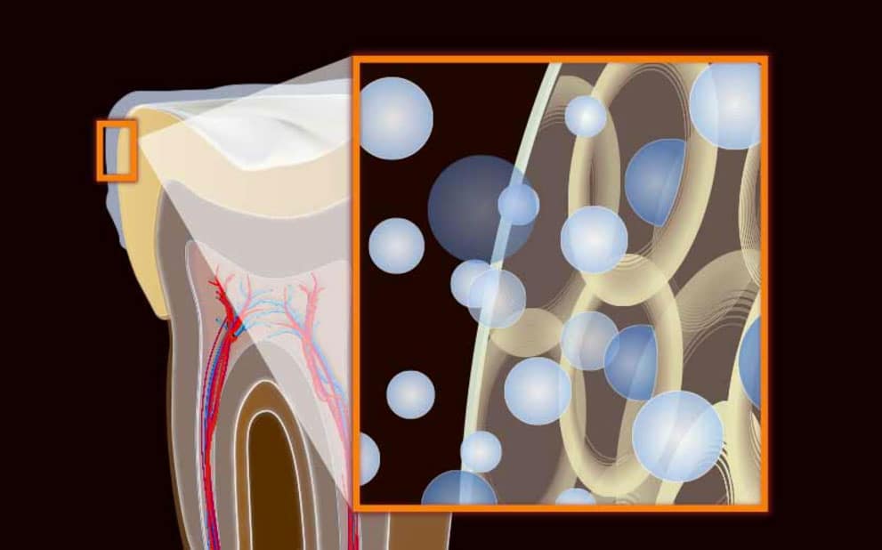 Fonctionnement blanchiment dentaire - Bruxelles - Clinique Apolline