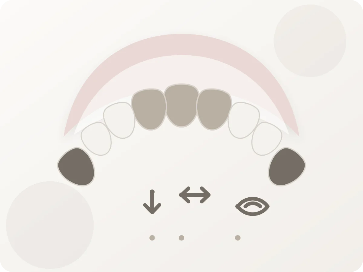 Schéma pédagogique de la dentition mixte vers 7 ans